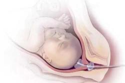 37岁二胎能顺产吗