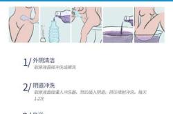 宫颈口紧怎么备孕