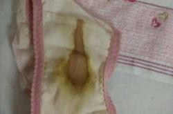 产后恶露是什么颜色的