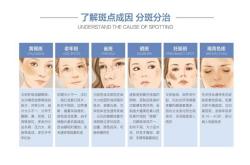 产后面部长斑该如何解决