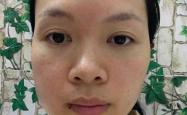 拔牙拍片不影响备孕吗