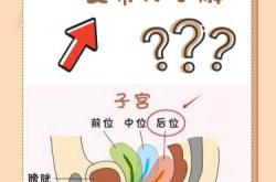 子宫前位容易顺产吗