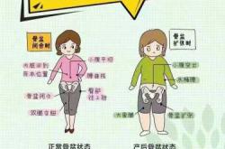 产后会怎样身体会有何变化