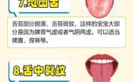 新生儿舌苔厚白怎么办