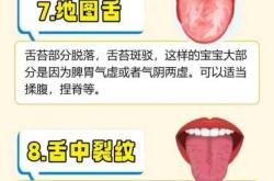 新生儿舌苔厚白怎么办