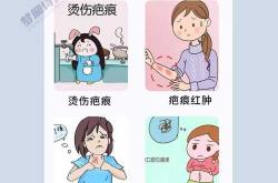 剖腹产腿痒是怎么回事