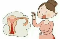 产后15天恶露褐色正常吗