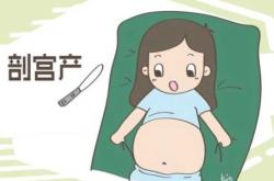 剖腹产要不要特意算日子