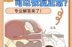 流产后为何会出现剧痛
