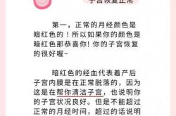 外国产后恢复注意什么