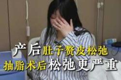 产后肚皮松弛多久可以恢复