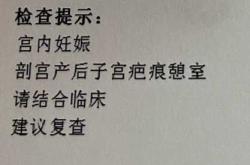 一胎剖腹产二胎能顺产吗