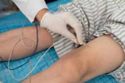 产后肌电图检查身体哪些部位