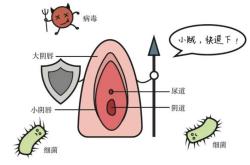产后易患哪些妇科病