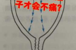 人流手术后为何还有孕反
