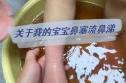 婴儿鼻屎多怎么办