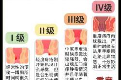 产后长痔疮会自然好吗