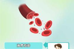 新生儿高胆汁酸血症怎么办