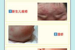 新生儿有点动静就惊醒咋回事