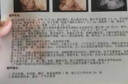 备孕二胎男性会有啥后果