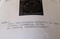 产后子宫有絮状回声怎么办