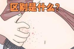 新生儿为何易长湿疹