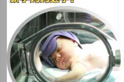 新生儿黄疸20严重吗