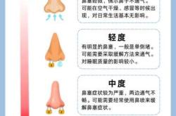 婴儿感冒鼻子不通气怎么办