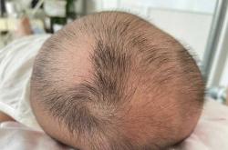 婴儿为何会出现变声现象