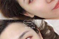 剖腹产疤痕能纹眉遮盖吗