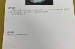 引产后多久能摸冷水