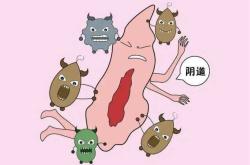 剖腹产后如何清洗外阴