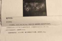 备孕能不能检查内检