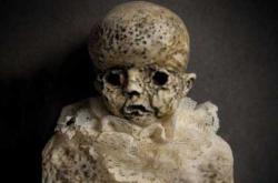 婴儿脸上有毛是怎么回事