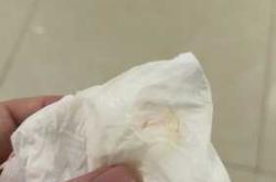 刨腹产后白带有血丝怎么办