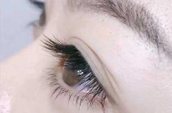 婴儿美图片大全有哪些