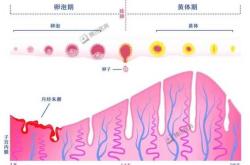 流产后子宫内膜为何会变薄