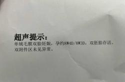 孕反会突然消失吗