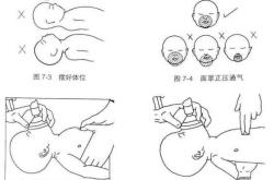 新生儿输注该注意什么