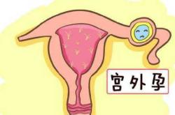 产后两个月突然又见红是咋回事