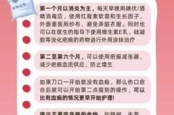 剖腹产如何防止伤口摩擦