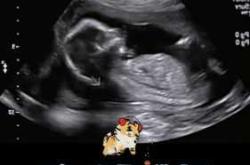 胎教音乐有什么作用