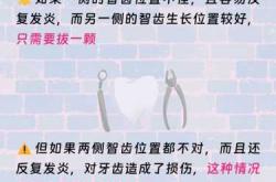 备孕时是否要先拔智齿