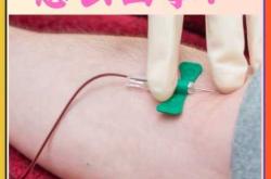 产后红细胞高是什么原因