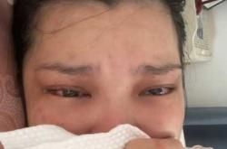 剖腹产后晕车是怎么回事