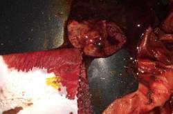 流产后从外表能看出来吗