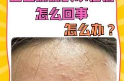 新生儿脸上长小疙瘩怎么办