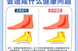 产后脚很干如何缓解