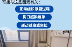 剖腹产后刀口下面为啥疼