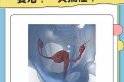 剖腹产后多久会排卵